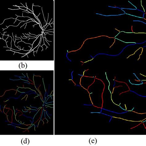 Image result for Channel AV Classification