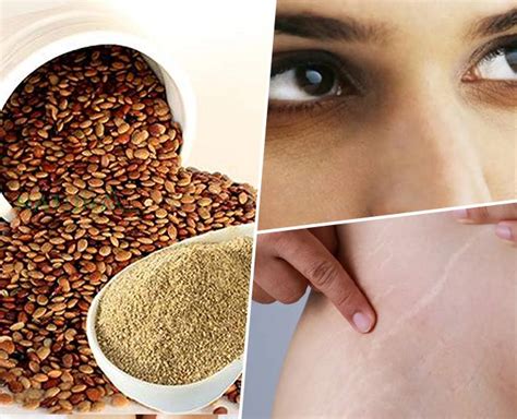 This Dal Is Elixir For Your Stretch Marks, Dark Circles, Glowing Skin ...