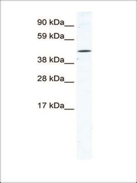 Anti-TTC19 (AB1) antibody produced in rabbit IgG fraction of antiserum ...