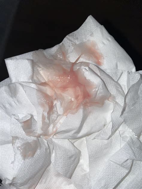 Yeast Infection Raw Skin Bleeding at Kathleen Flores blog