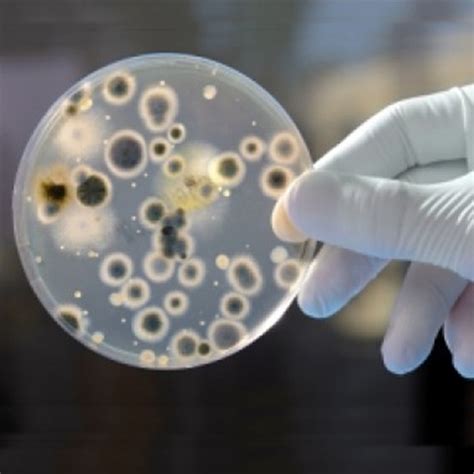 What are important bacterial zoonotic in India?