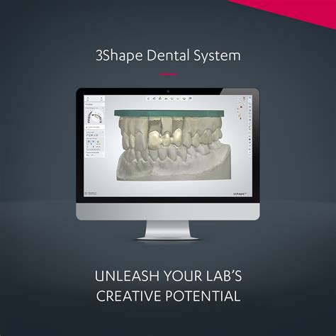 3Shape Dental System® - an Integrated CAD/CAM Solution for Labs