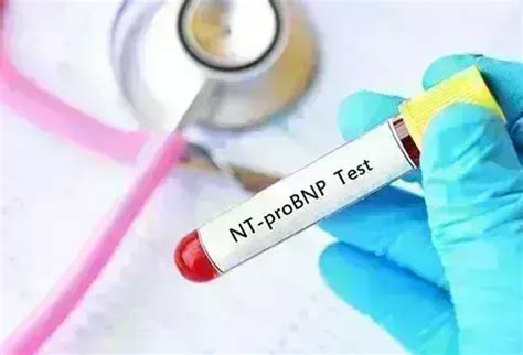 Is NT-proBNP reliable for heart failure diagnosis in Indian patients ...