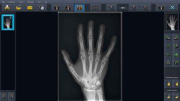 X-AQS X-ray software for human medicine | EXAMION