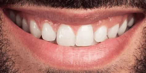 Best dental clinic in ahmedabad - DentoSphere