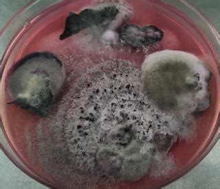iThink Biology: The kingdom of fungi
