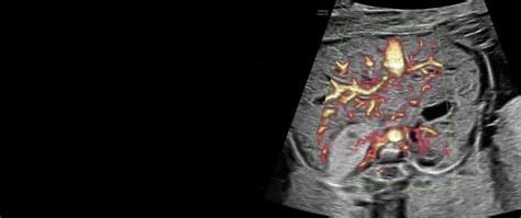 Voluson Expert 22 Imaging Capabilities | GE HealthCare (India)