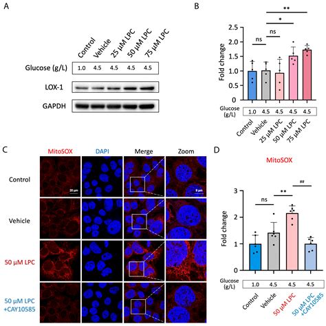 Lysophosphatidylcholine Impairs the Mitochondria Homeostasis Leading to ...