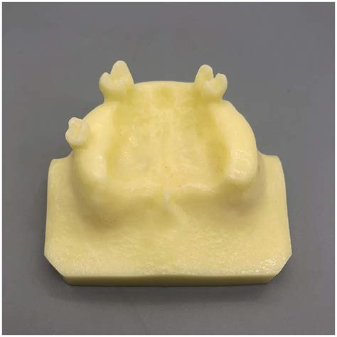 Buy Maxillary Im Template of Sinus Ascension Ascension, Oral Teeth Im ...