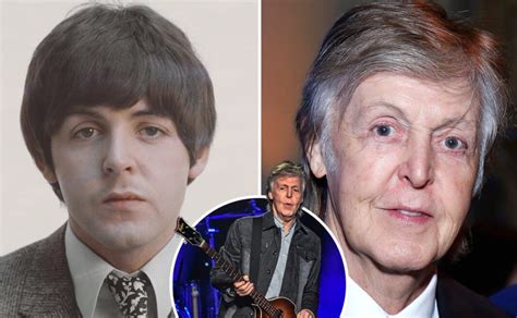 Paul McCartney Plastic Surgery - With Before And After Photos