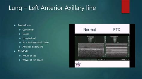 E-Fast Examination | PPTX
