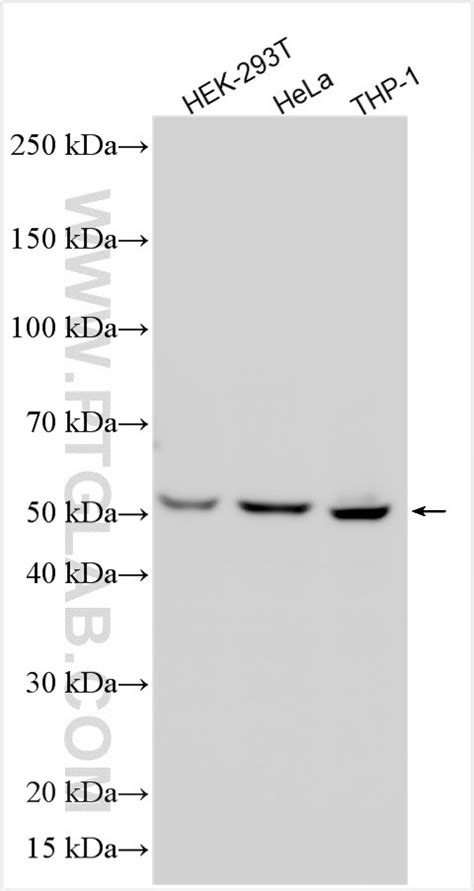 RIPK2 antibody (15366-1-AP) | Proteintech