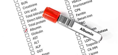 Albumin Blood Test Explained: What Your Results Really Say About Your ...