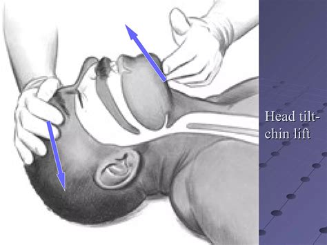 CPR( Cardiopulmonary Resuscitation | PPT