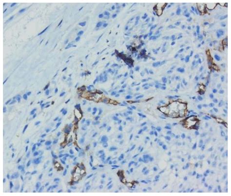Actualities in the Morphology and Immunohistochemistry of Cutaneous and ...