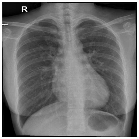 Hybrid Vision Transformer and Convolutional Neural Network for Multi ...