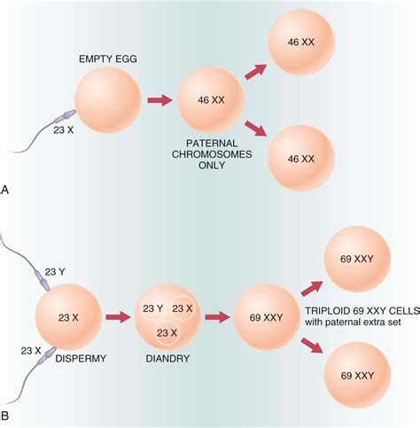 Gestational Trophoblastic Diseases - Clinical Tree