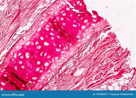 Elastic Cartilage Under Microscope