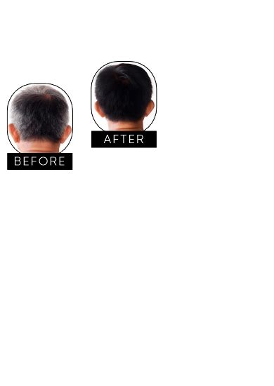 Buy Lely's Skin & Haircare Products Online at Best Price - Lelys – E ...