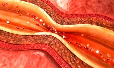 What is role of acetylcholine rechallenge in treatment of coronary ...
