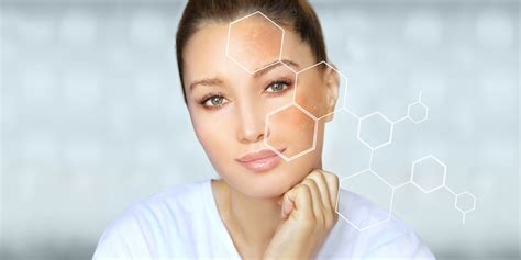 How to Reduce Melanin in Skin, Tips to Decrease Melanin Naturally – The ...