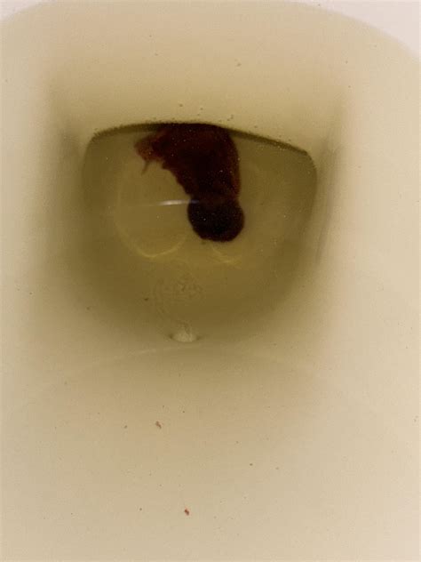 TW big blood clot. This came out of me and I’m scared : r/Periods