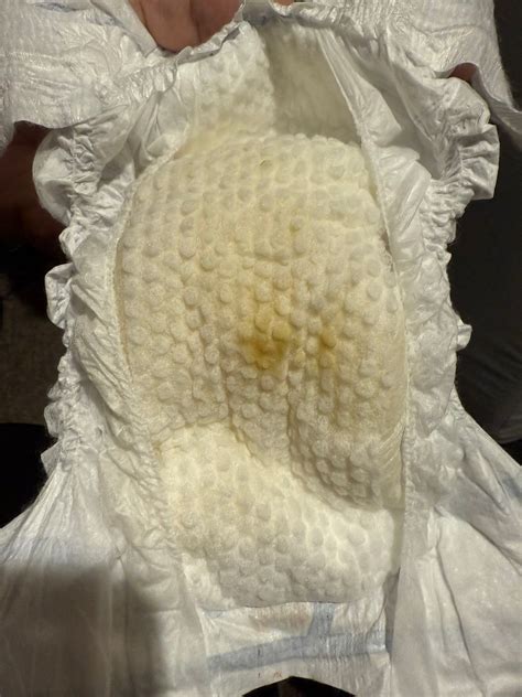 Yellow Spot on Diaper | BabyCenter