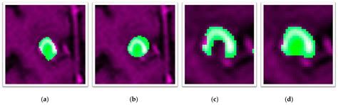 Investigating the Behaviour of Machine Learning Techniques to Segment ...