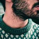 How To Prevent Scratchy Beard Burn and Rash When Kissing / Advice ...