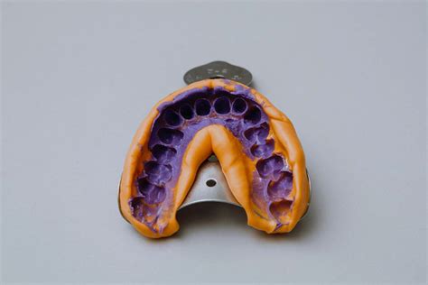 Dental Impression Classification at Missy Lynch blog