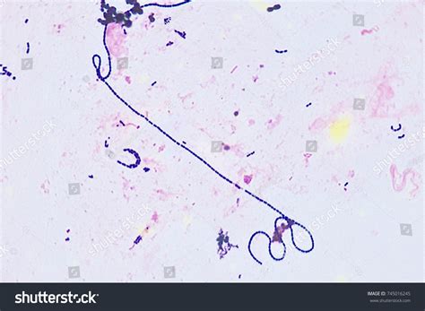 Gram Positive Cocci Chain Bacteria Stock Photo (Edit Now) 745016245