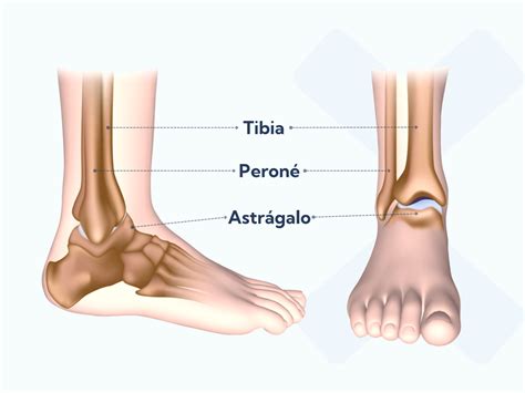 Esguinces de tobillo: tipos, causas y tratamientos más indicados