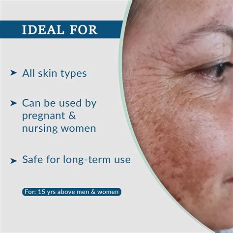 Aha Lightening Gel 30 ml Price, Uses, Side Effects, Composition ...