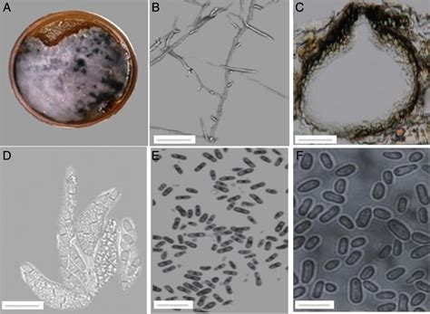 Antifungal and antioxidant potential of Ocimum species against ...
