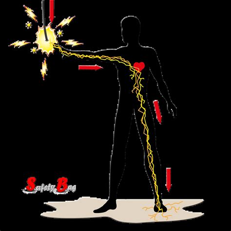 Electricity Shock 的图像结果