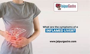 Image result for Inflamed Liver