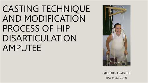 Casting Technique and Modification process of Hip Disarticulation.pptx