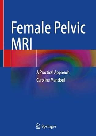 Buy Female Pelvic MRI: A Practical Approach Book Online at Low Prices ...
