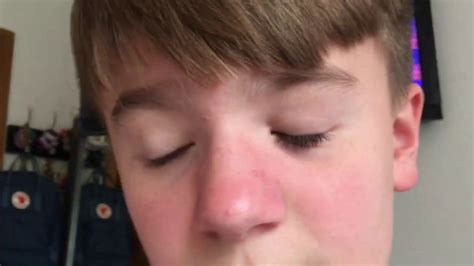 Image result for Exploding Zit Videos 2013