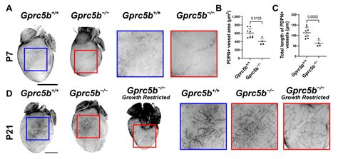 Orphan G-Protein Coupled Receptor GPRC5B Is Critical for Lymphatic ...