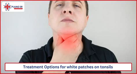 White Patches on Tonsils: Causes & Treatment at Plano ER