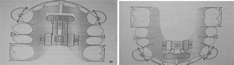 Application of magnets in orthodontics –A review - IP J Surg Allied Sci