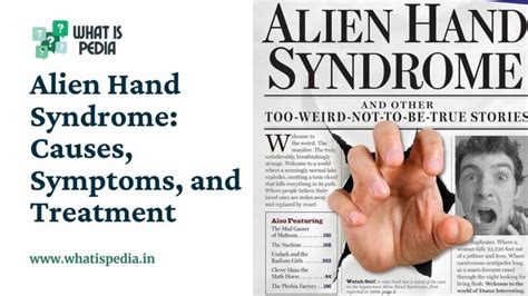 Image result for Alien Hand Syndrome Real