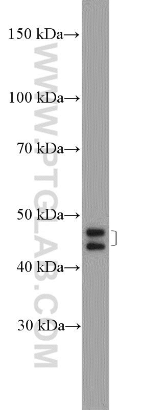 ZNF586 antibody (25023-1-AP) | Proteintech