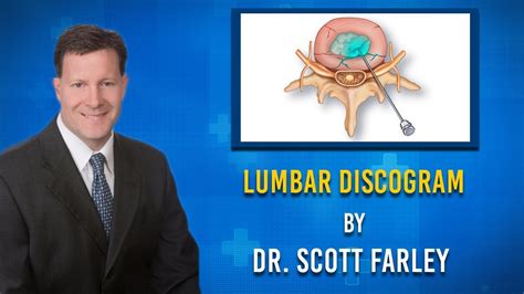 Image result for Lumbar Discogram