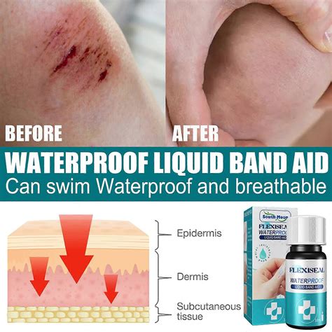 Medical Glue For Cuts, Fast-drying & Breathable Liquid Skin Bandage ...
