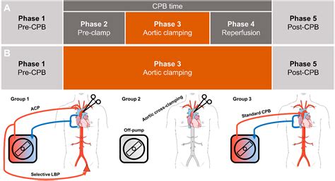 Renal Blood Flow Cardiopulmonary Bypass at Jami Starkey blog
