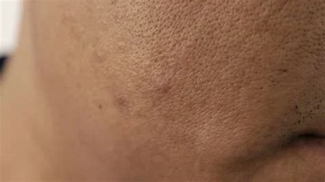 Image result for Condition Cheeks