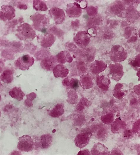 Campylobacter jejuni〔カンピロバクター〕 | グラム染色: Gram Stain