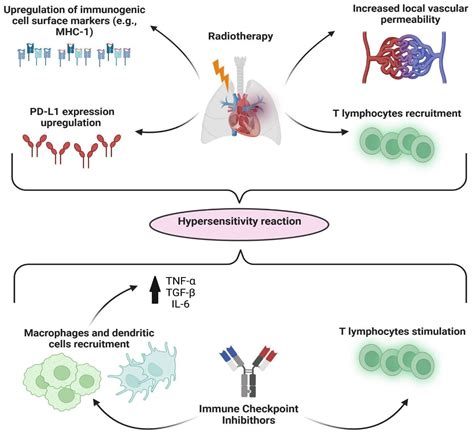 Radiation Recall Pneumonitis Anticipates Bilateral Immune-Induced ...